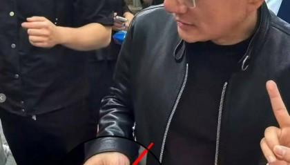黄仁勋的指甲冲上热搜！高清镜头曝光，网友吵翻！医生：这6种情况都可能